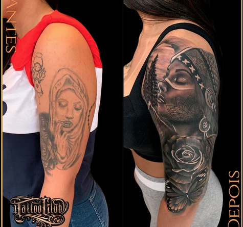 Cobertura de tatuagens tem superado as remoções a laser