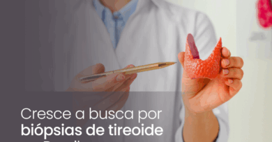 Cresce a busca por biópsias de tireoide no Brasil