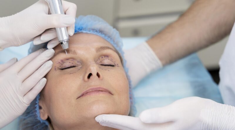 Rejuvenescimento facial alia diferentes técnicas