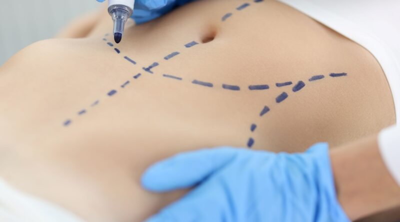 Cirurgia plástica: busca por resultado natural é tendência
