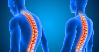 Cirurgia de escoliose é a 1ª com neuronavegação em Uberlândia