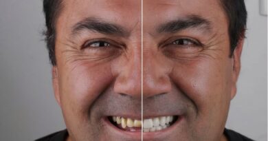 Tecnologia ajuda dentistas a prever resultados estéticos