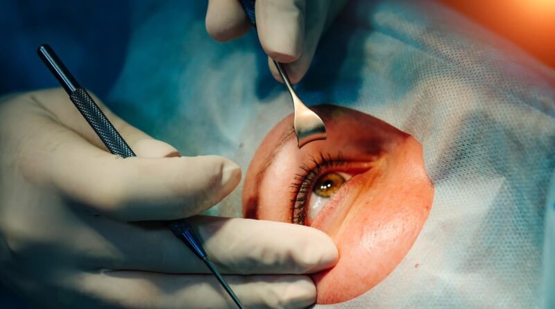 Cirurgia de catarata evolui e amplia recuperação da visão