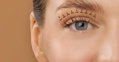 Blefaroplastia envolve função ocular além da estética