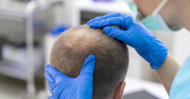 Medicina capilar avança e amplia possibilidade de tratamento
