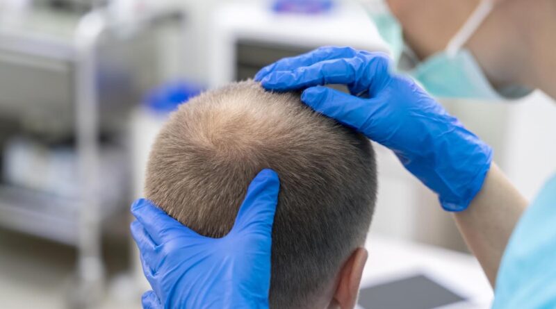 Medicina capilar avança e amplia possibilidade de tratamento