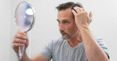 Tratamentos ampliam alternativas para calvície masculina
