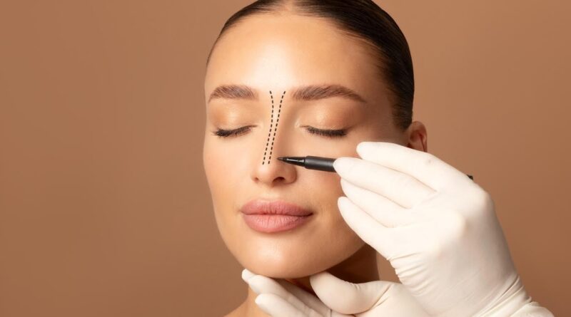Rinoplastia associa correção estética e função respiratória