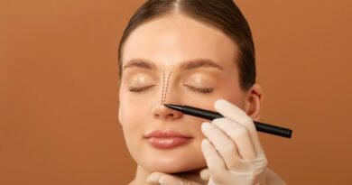 Rinoplastia alia estética e função respiratória