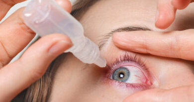 Tratamento da rosácea ocular avança com uso de tecnologia