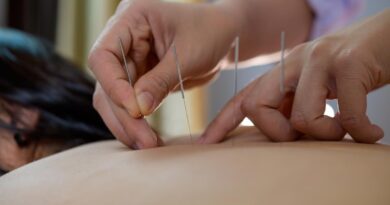 Acupuntura se consolida como prática terapêutica