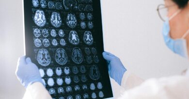 BrainAge: tecnologia indica a idade cerebral