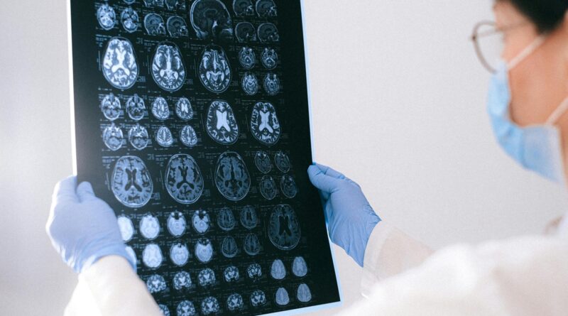 BrainAge: tecnologia indica a idade cerebral