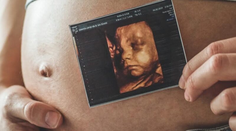 Ultrassonografia obstétrica avança no diagnóstico pré-natal