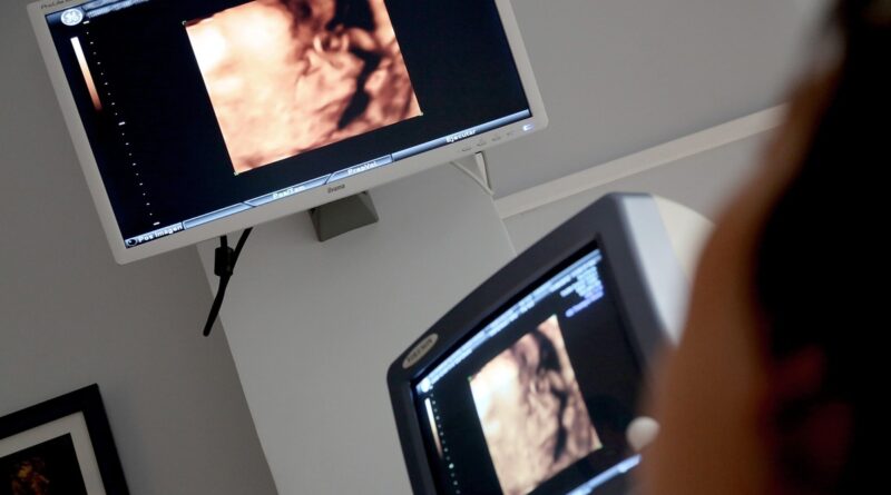 Pesquisa reforça técnica fetal para hérnia diafragmática