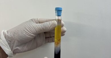 CFM regulamenta PRP em condições osteomusculares