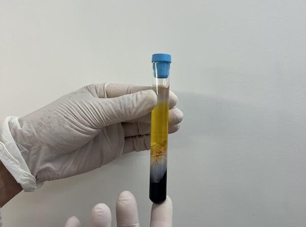 CFM regulamenta PRP em condições osteomusculares