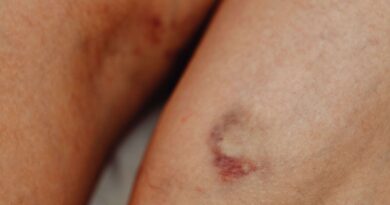 Alta mortalidade de doenças da aorta motiva congresso