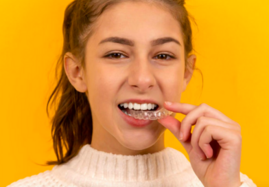 Alinhador invisível: como funciona o tratamento dentário