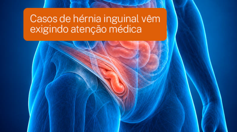 Casos de hérnia inguinal vêm exigindo atenção médica