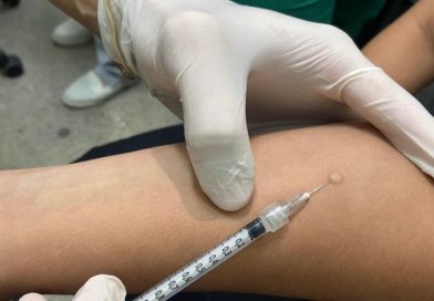 Prefeitura de Manaus amplia oferta do teste tuberculínico para 55 unidades de saúde na capital